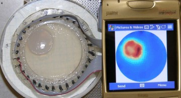 Gadgets: Telefonul mobil, la un pas de a deveni echipament medical de analize