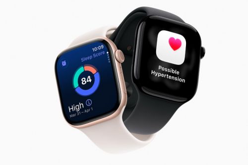 apple watch series 11 