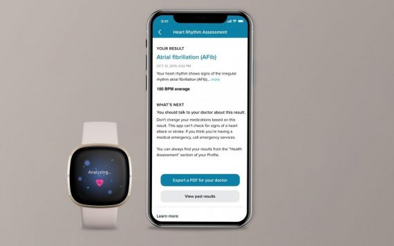 Fitbit Sense