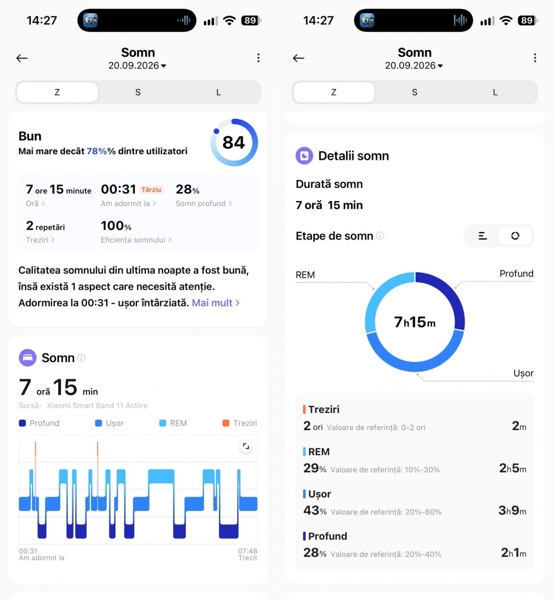 Xiaomi SmartBand 11 Active