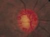 Google foloseşte AI-ul pentru a prezice bolile de inimă prin scanarea oculară
