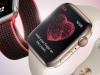 Apple Watch devine mai profitabil pentru Apple decât a fost iPod-ul (vreodată)