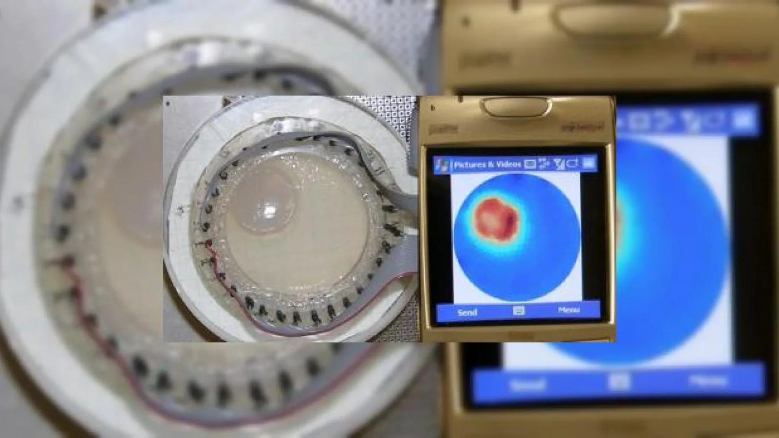 Telefonul mobil, la un pas de a deveni echipament medical de analize