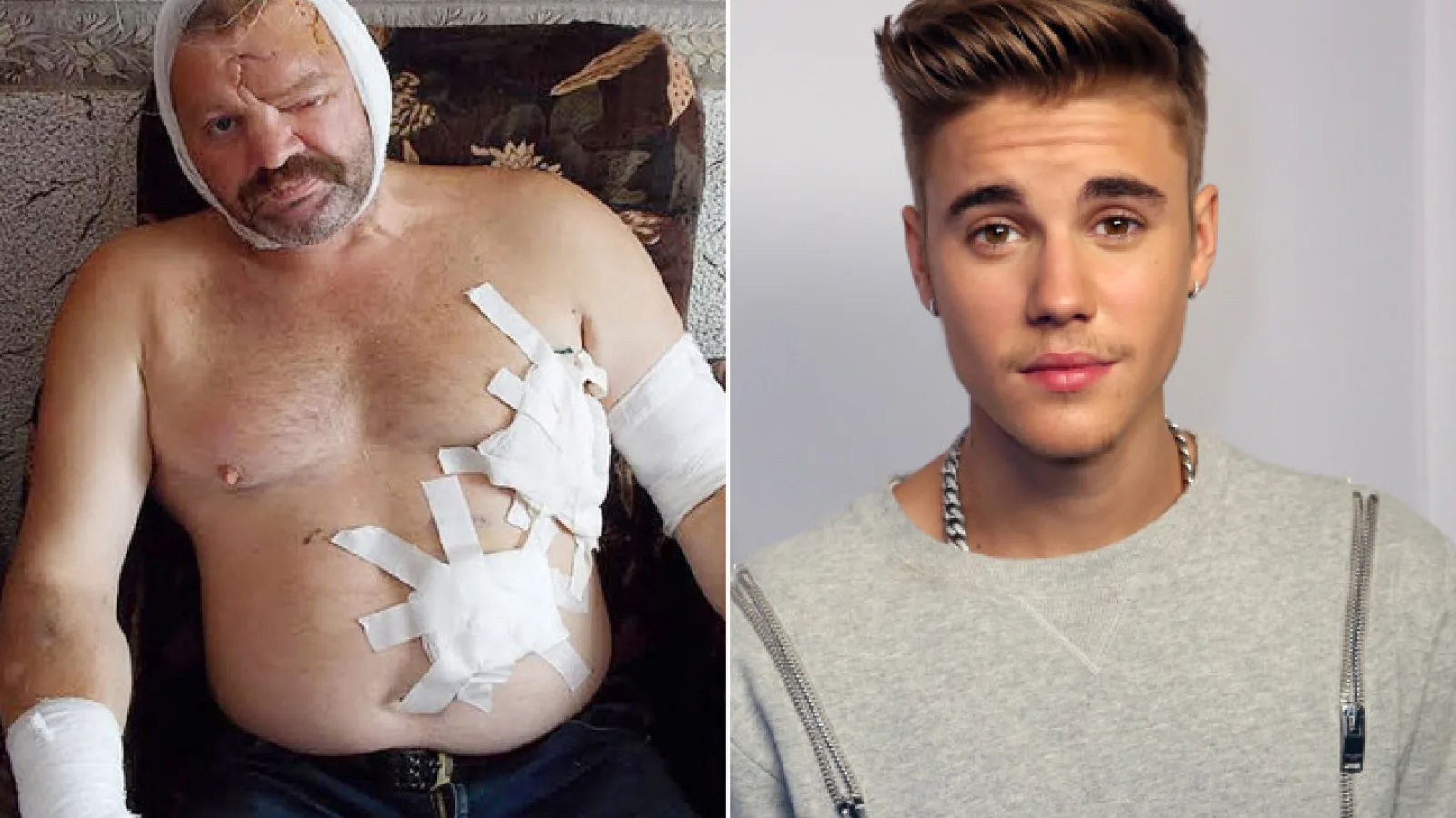 Un telefon cu sonerie o melodie a lui Justin Bieber salvează un bărbat de atacul unui urs