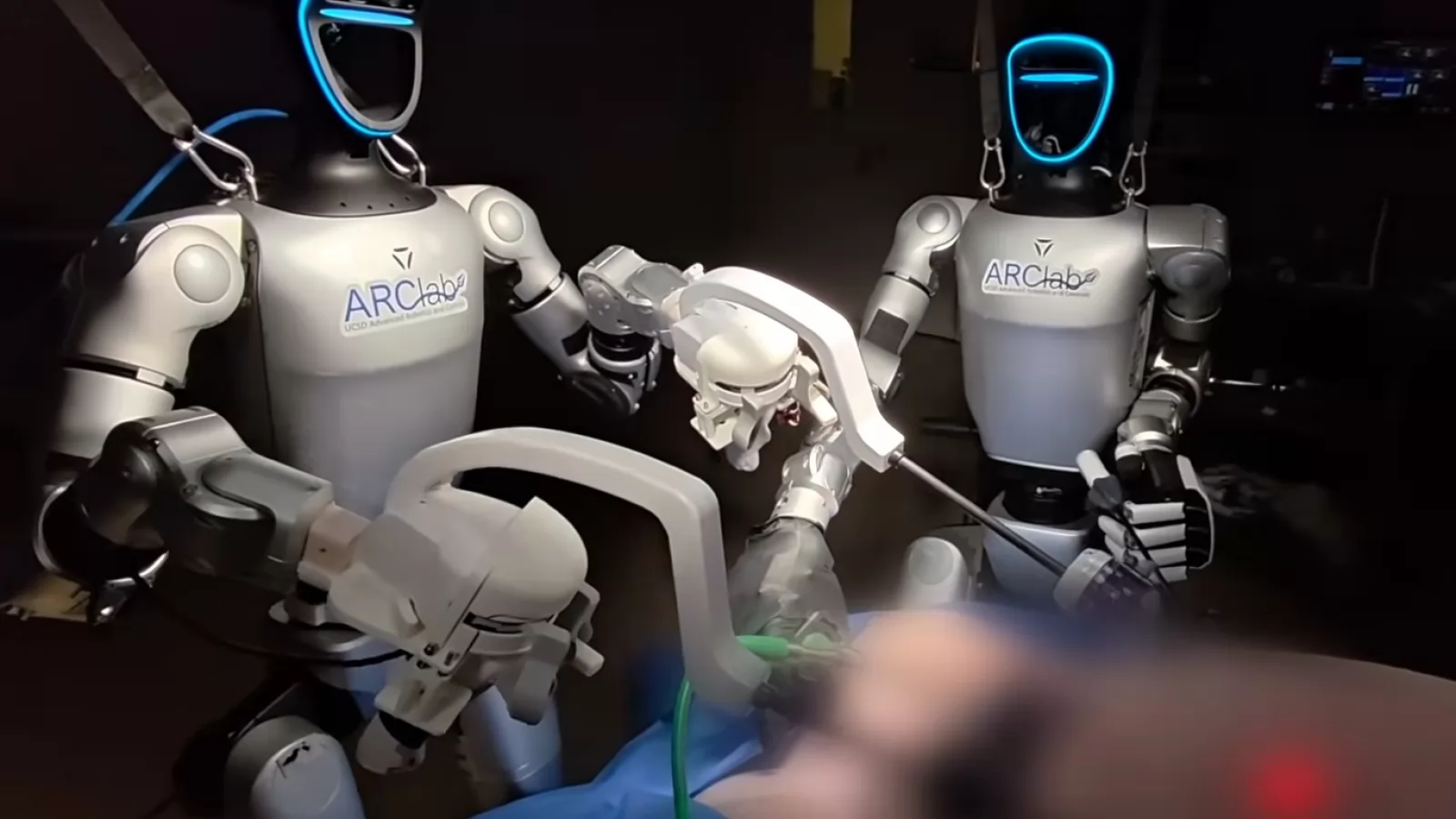 Premieră în medicină: un robot umanoid a realizat cu succes o operație de îndepărtare a vezicii biliare
