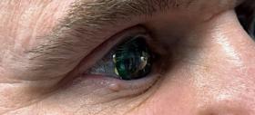 Mojo Vision - lentila de contact inteligentă cu AR, a fost purtată de către CEO-ul companiei şi este funcţională acum