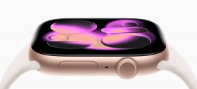 Apple Watch primește funcție de detectare a hipertensiunii cu watchOS 26; Dar nu cum v-ați aștepta
