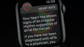 Apple Watch trimite prea mulţi oameni la doctor, alarmându-i legat de afecţiuni cardiace