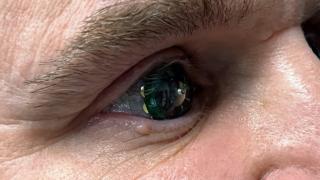 Mojo Vision - lentila de contact inteligentă cu AR, a fost purtată de către CEO-ul companiei şi este funcţională acum