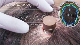 Elon Musk începe testele pe oameni cu Neuralink în 2023: cipuri instalate în creiere umane