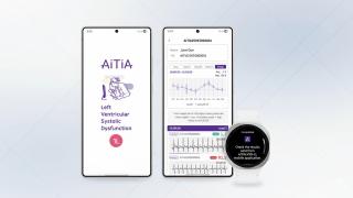 Prevenţia dementei cu ajutorul ceasului? Iată la ce a lucrat Samsung pentru Galaxy Watch şi vine la CES 2026