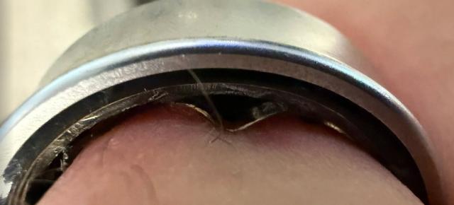 Un utilizator de inel inteligent a ajuns la spital; Galaxy Ring-ul s-a umflat pe deget