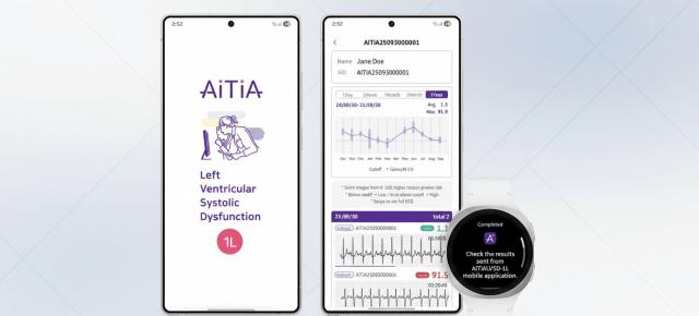 Prevenţia dementei cu ajutorul ceasului? Iată la ce a lucrat Samsung pentru Galaxy Watch şi vine la CES 2026