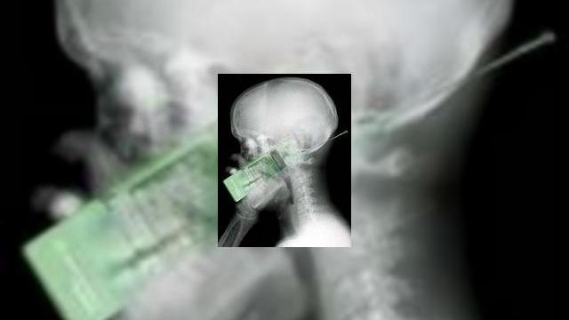 <b>Barbat chinez ucis de explozia unui telefon mobil</b>In China, un barbat a murit dupa, ce se pare, telefonul sau mobil a explodat in buzunarul sau de la piept. Sudor, Xiao Jinpeng lucra la Instalatia de Preparare a Minereurilor Yingpan din provincial vestica Gansu, cand, conform rapoartelor, telefonul sau...