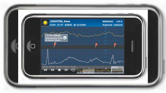 <b>7 aplicatii pentru iPhone care pot salva vieti</b>Cele mai noi aplicatii de pe iPhone pot face orice in ziua de azi, de la a emula o consola veche de jocuri, pana la salvarea vietii unui om, prin intermediul sfaturilor practice. Iata ca mashable pune accentul pe cele mai utile 7 applicatii iPhone, care...