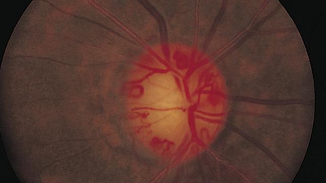 <b>Google foloseşte AI-ul pentru a prezice bolile de inimă prin scanarea oculară</b>Era de așteptat ca Inteligența Artificială (AI-ul) să își facă apariția și în domeniul medical, acolo unde Google au planuri mărețe se pare. Un test realizat de către marele G de curând se folosește de acest AI pentru a prezice bolile la inimă