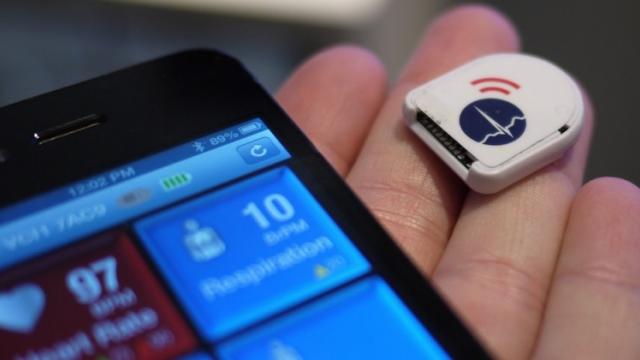 <b>Apple cooptează doi specialiști În biosenzori pentru un produs "ce se poate purta"; iWatch cu functii medicale?</b>Au reînceput zvonurile legate de ceasul Apple, odată cu aflarea faptului că Apple a adăugat la echipa să 2 experți în senzori medicali. Acești senzori sunt integrați de obicei pe brățări sau alte accesorii purtate de pacienți. Să fie iWatch...