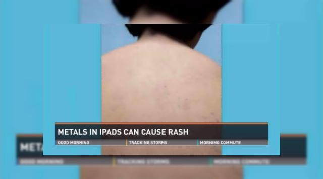 <b>Alergie la iPad? Multe cazuri de iritații și erupții provocate de nichelul tabletelor au fost confirmate</b>Preluată de la Fox News și eruptă în publicații că Daily Mail "alergia la iPad" poate sună ciudat la prima vedere. E de fapt vorba despre o iritație sau erupție provocată de alergia la nichelul care e folosit la destul de multe tablete. &nbsp;...