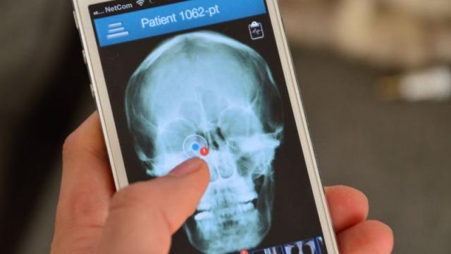 <b>Aplicațiile medicale ușurează tratarea pacienților de la distanță; Acum există și psihiatria prin telefon! (Video)</b>Se pare că tehnologia avansată din domeniul telecom contribuie și la evoluția medicinei, astfel că doctorii se pot folosi de aplicațiile de pe smartphone-uri pentru a trata pacienții mai ușor și de la distanță. Specialiștii pot obține date...