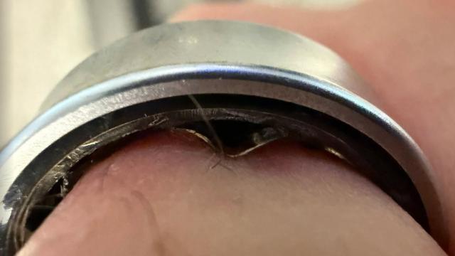 <b>Un utilizator de inel inteligent a ajuns la spital; Galaxy Ring-ul s-a umflat pe deget</b>Se pare că nu doar telefoanele mobile pot să sufere de o baterie umflată în timp, ci şi... purtabilele. E mai rău când porţi acel dispozitiv pe o parte a corpului tău, în acest caz un deget. Cineva a ajuns la spital după ce Samsung Galaxy Ring-ul 
